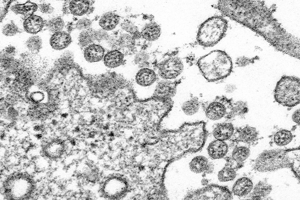 コロナウイルスの透過型電子顕微鏡像 - CDCより